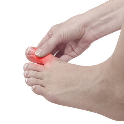 ayak-bas-parmak-kireclenmesi