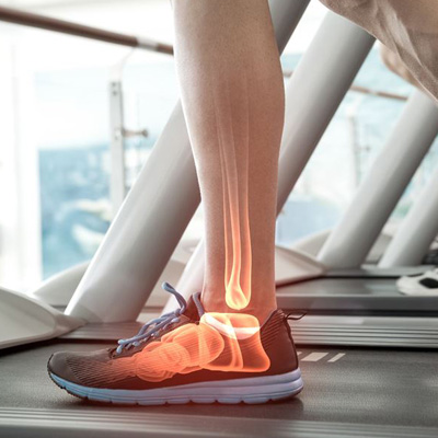 ayak-bilegi-artroskopisi-1