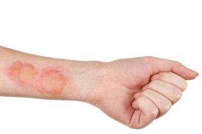 Spor Cerrahisi (Artroskopi)