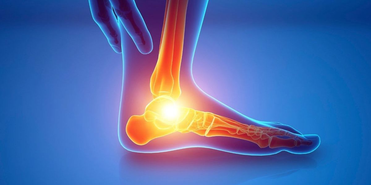 Düşük Ayak Sendromu Nedir