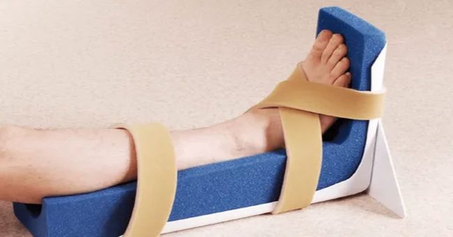 düşük-ayak-sendromu-tedavisi-3 Düşük Ayak Sendromu Tedavisi