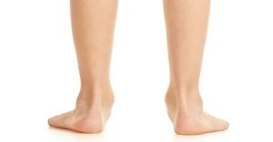 Düz Tabanlık Nedir?