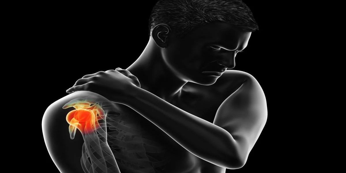 Omuz Sıkışması Sendromu Nedir