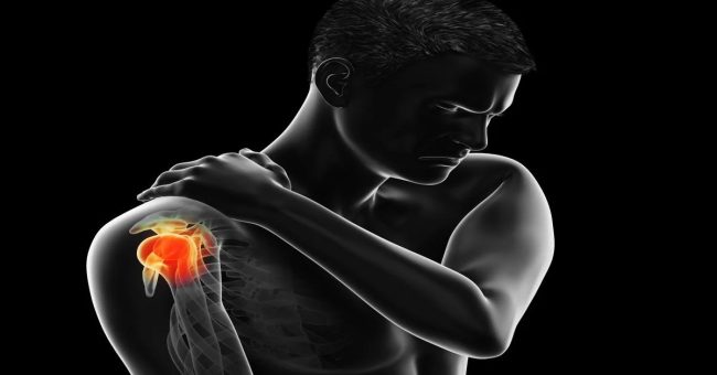 omuz-2 Omuz Sıkışması Sendromu Nedir