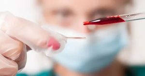 Kök Hücre Tedavisi Nedir? Kök Hücre Tedavisi Nedir?