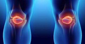Menisküs Yırtığı Ameliyatı Menisküs Yırtığı Ameliyatı