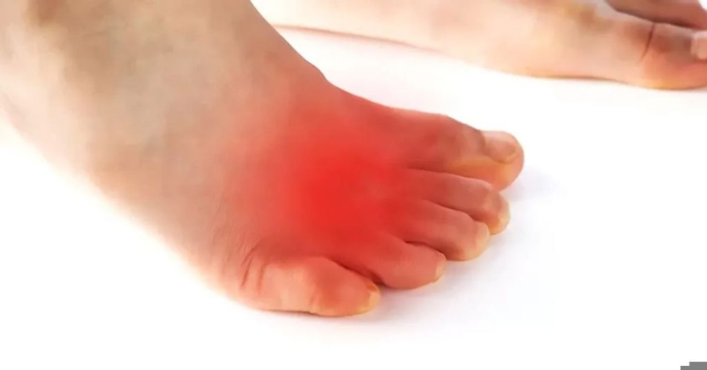 Freiberg Hastalığı Ameliyatı