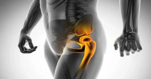 Kalça Sıkışması Sendromu Ameliyatı Kalça Sıkışması Sendromu