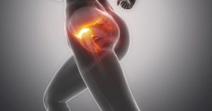 Kalça Sıkışması Sendromu Ameliyatı Kalça Sıkışması Sendromu