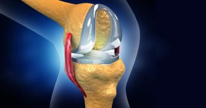 Total Diz Protezi Ameliyatı
