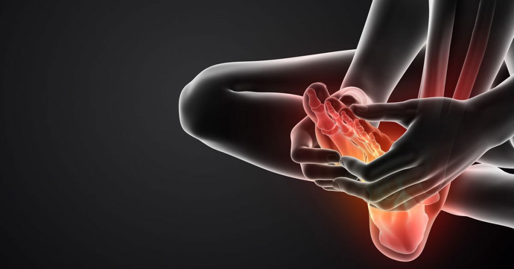 Düşük Ayak Sendromu Tedavisi