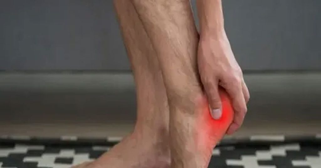 Haglund Hastalığı Tedavisi