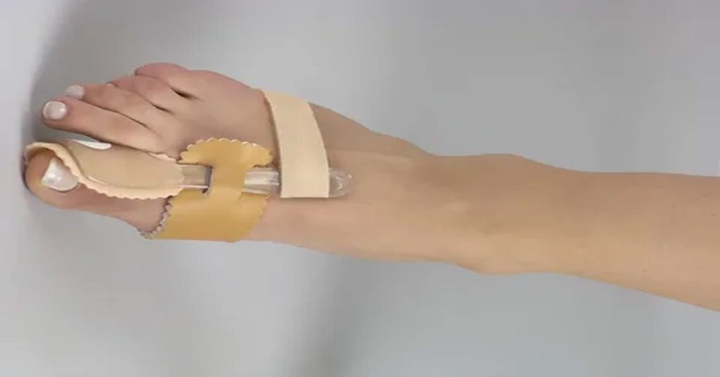 Çekiç Parmak Ameliyatı