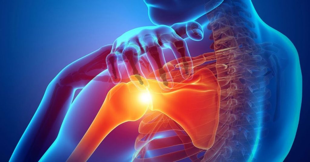 Omuz Çıkığı Ameliyatı