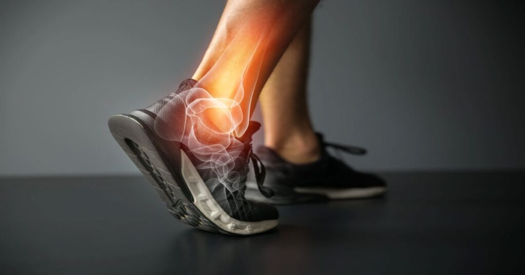 Aşil Tendon Kopması Belirtileri